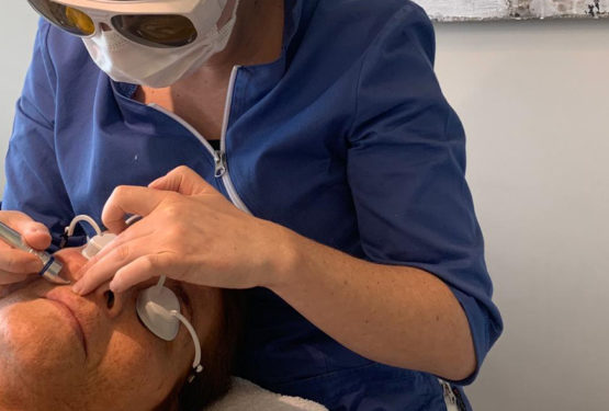 De winter is het ideale moment voor een IPL laserbehandeling!