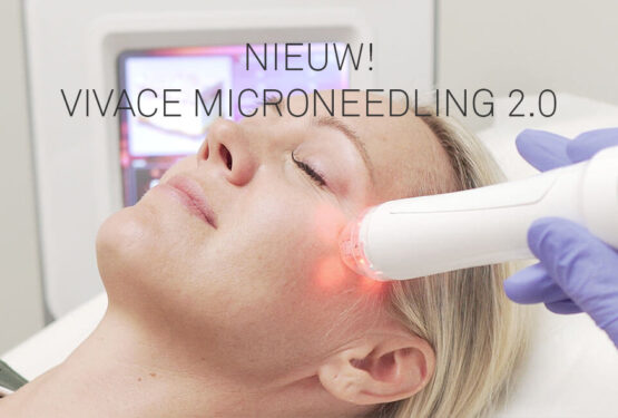 Introductie aanbieding Vivace Microneedling