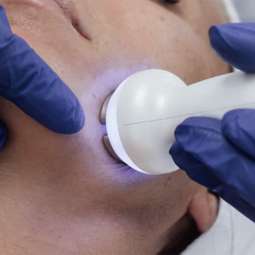 Hydrofacial