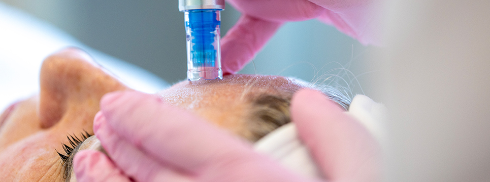 Vievermans Huidkliniek | Kiezen voor Vievermans Huidkliniek